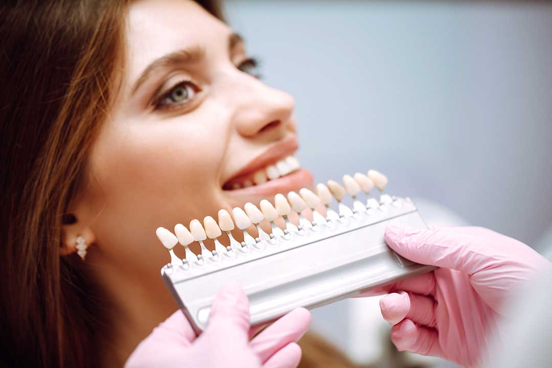 Things to Know Before Your Teeth Whitening Appointment