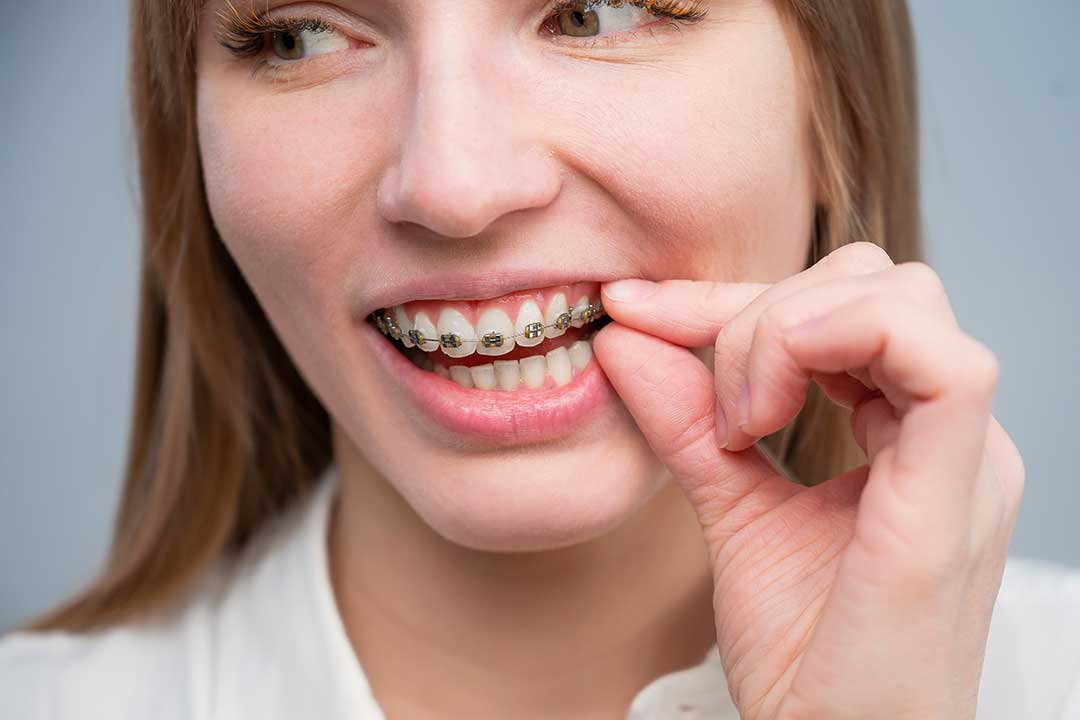 Do teeth become loose with braces?