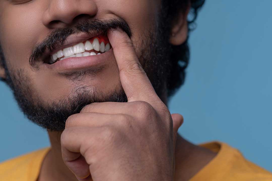 How do dentists treat receding gums?