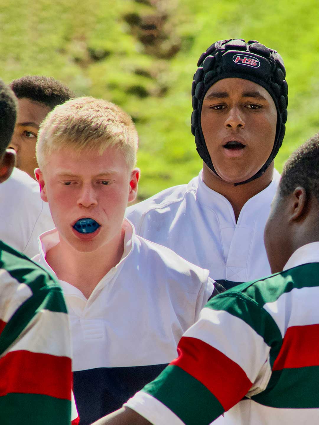 Mouth Guards in Dubai