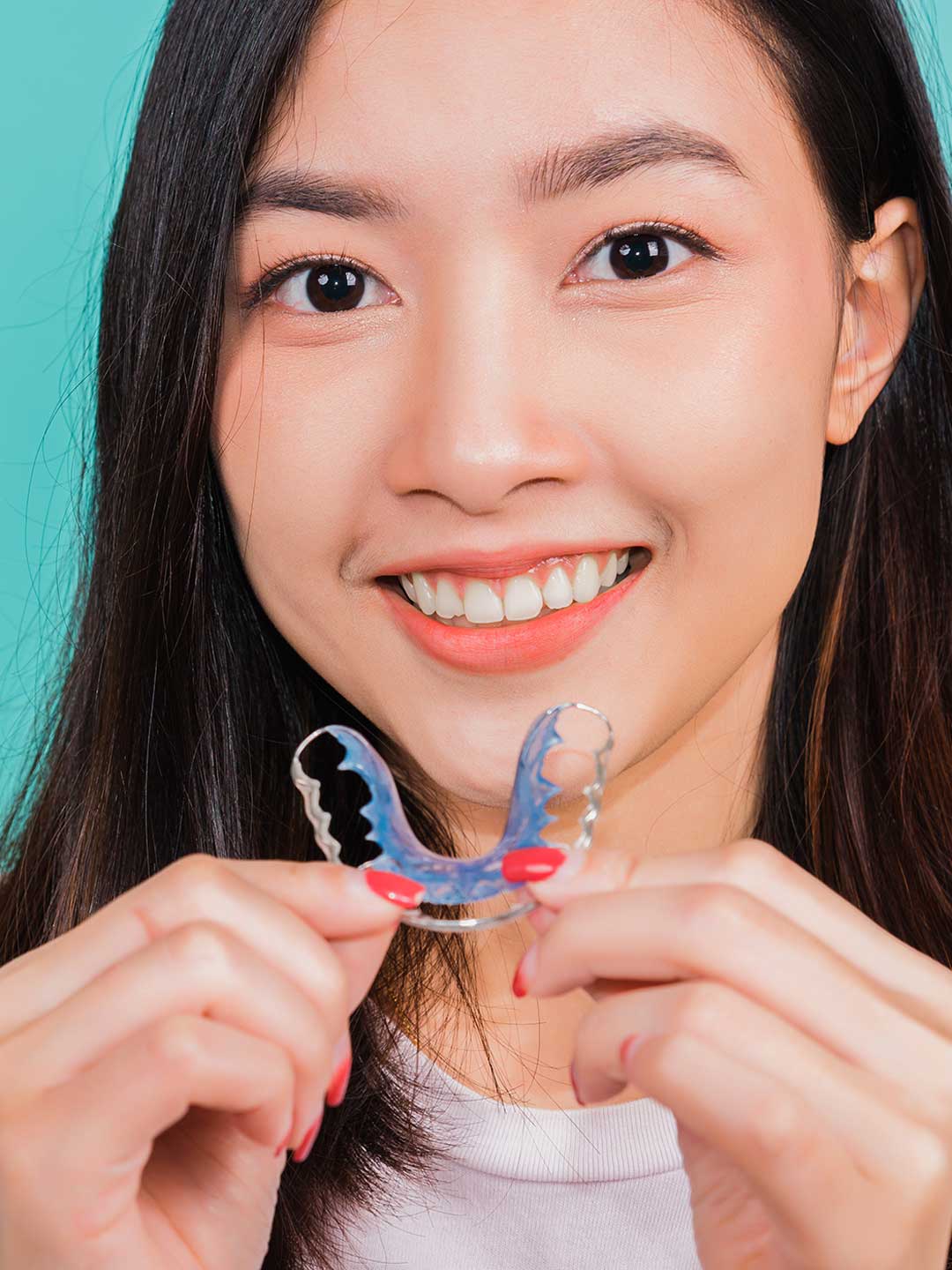 Teeth Retainers in Dubai